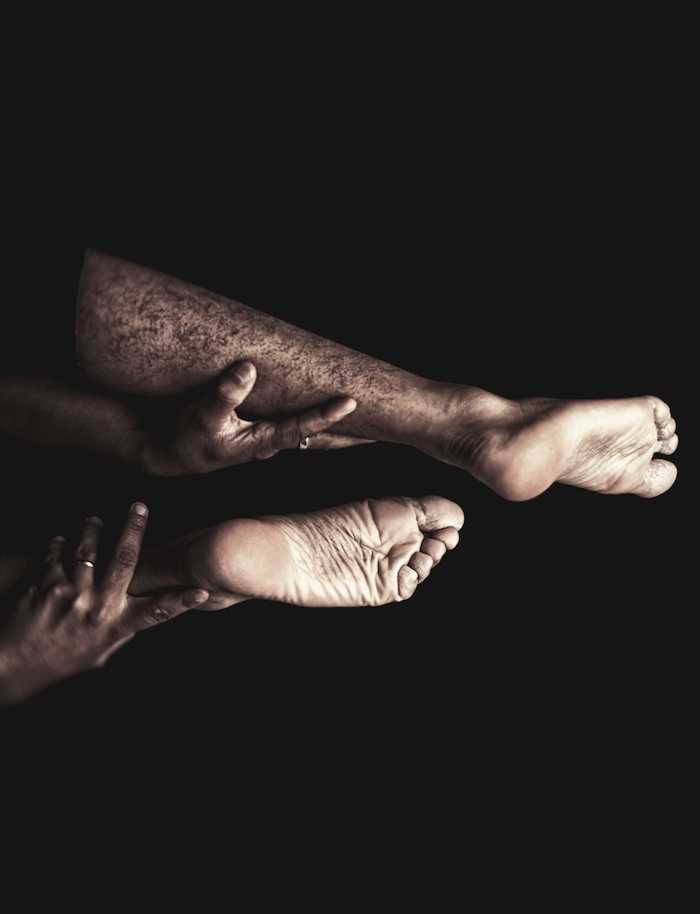 limbs.